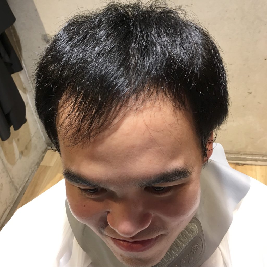 男性の薄毛でヘアスタイルが決まらない方必見 薄毛が目立たないヘアスタイル提案 福岡市博多区の男性専門美容室 Men S Hair Aratana